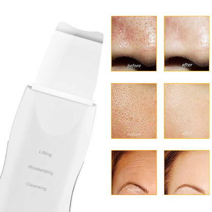 Limpiador Facial ELÉCTRICO