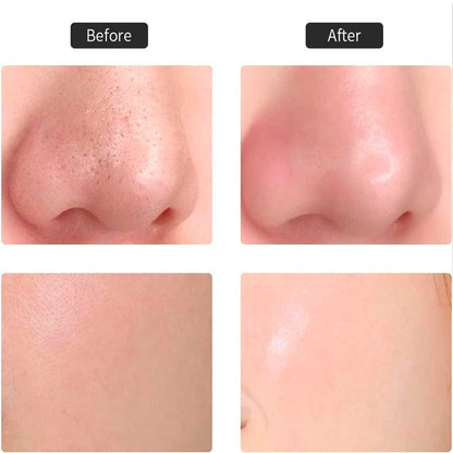 Limpiador Facial ELÉCTRICO