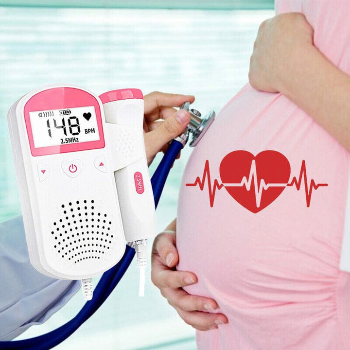 BabyCheck: Doppler fetal🤰